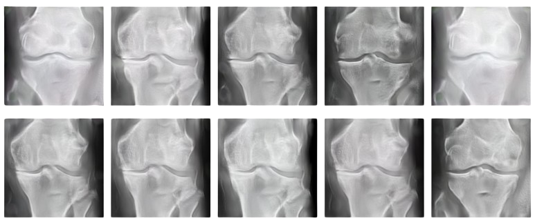 Synthetic Knee Images Generation